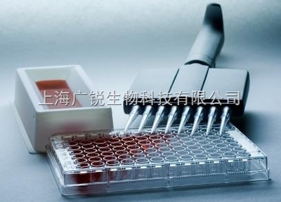 小鼠堿性成纖維細胞生長因子4(bFGF-4)進口ELISA試劑盒 精準檢測的專業(yè)之選
